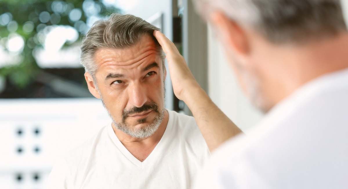 Hombre revisando su línea capilar frente al espejo